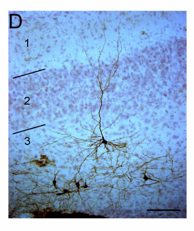 Células madres trasplantadas en el cerebro pueden formar las conexiones necesarias 