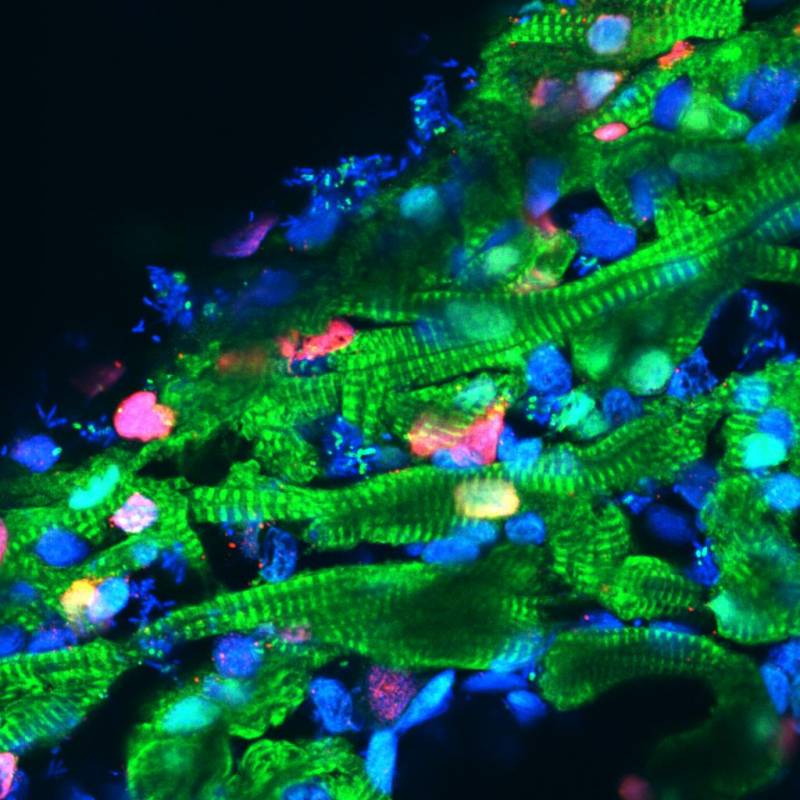 Imagen confocal de cardiomicitos identificados de pez cebra.