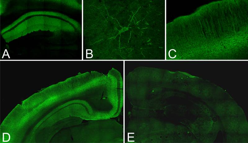 Muestras de los cerebros analizados.