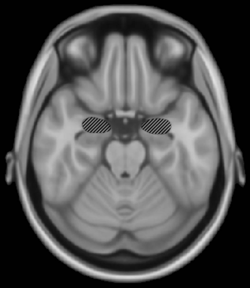 Dos estructuras cerebrales son clave para el equilibrio emocional en situaciones amenazantes