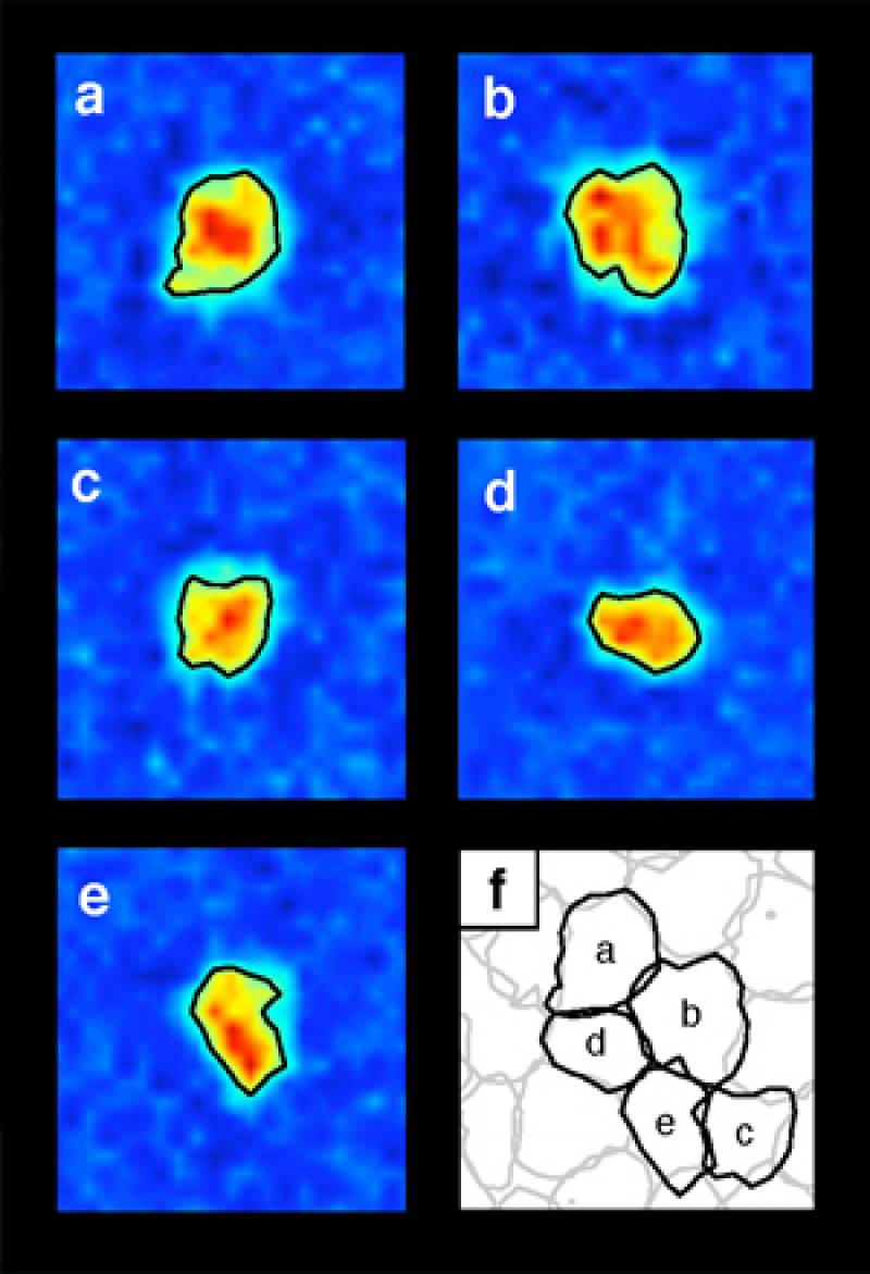 La retina, un puzzle de más de un millón de piezas