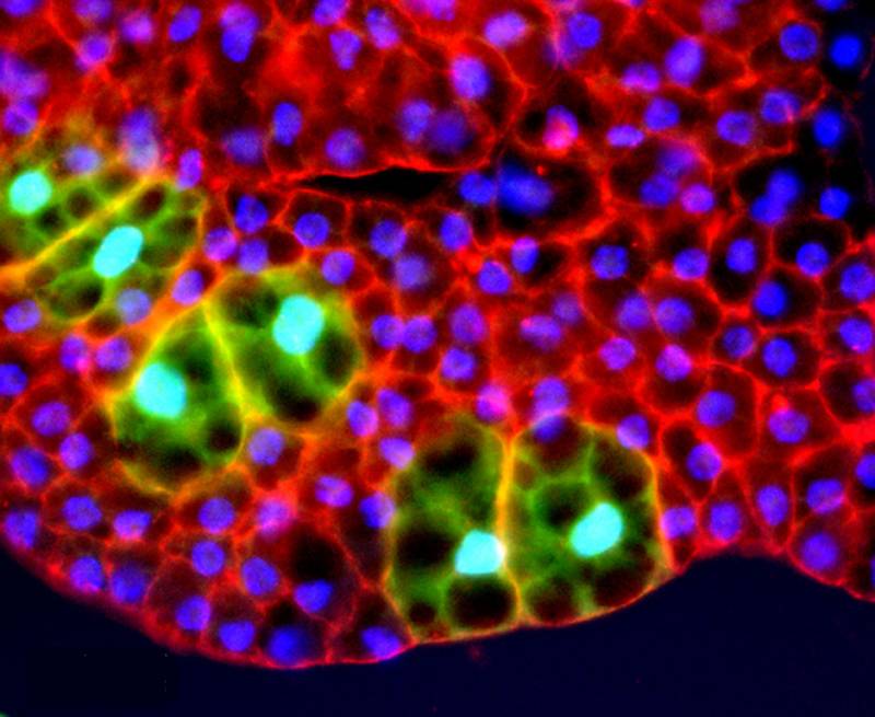 El estudio se ha realizado con células de la mosca  Drosophila, como las de la imagen. 