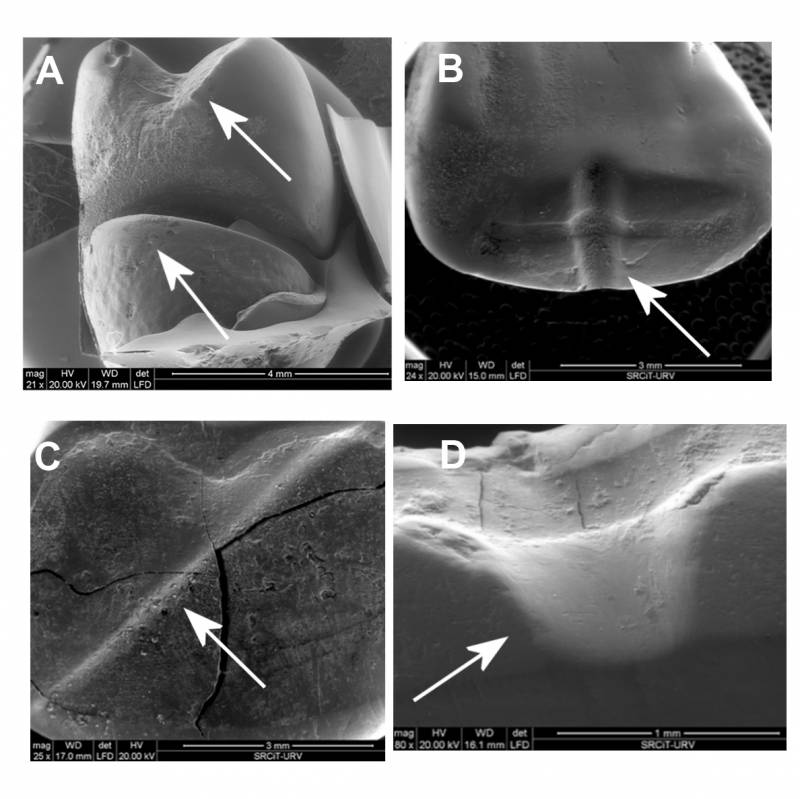 Surcos en la dentición de diferentes individuos femeninos del yacimiento de Castellón Alto, indicativos del trabajo con cuerdas e hilos (las flechas indican el desgaste dental). / Marina Lozano/IPHES