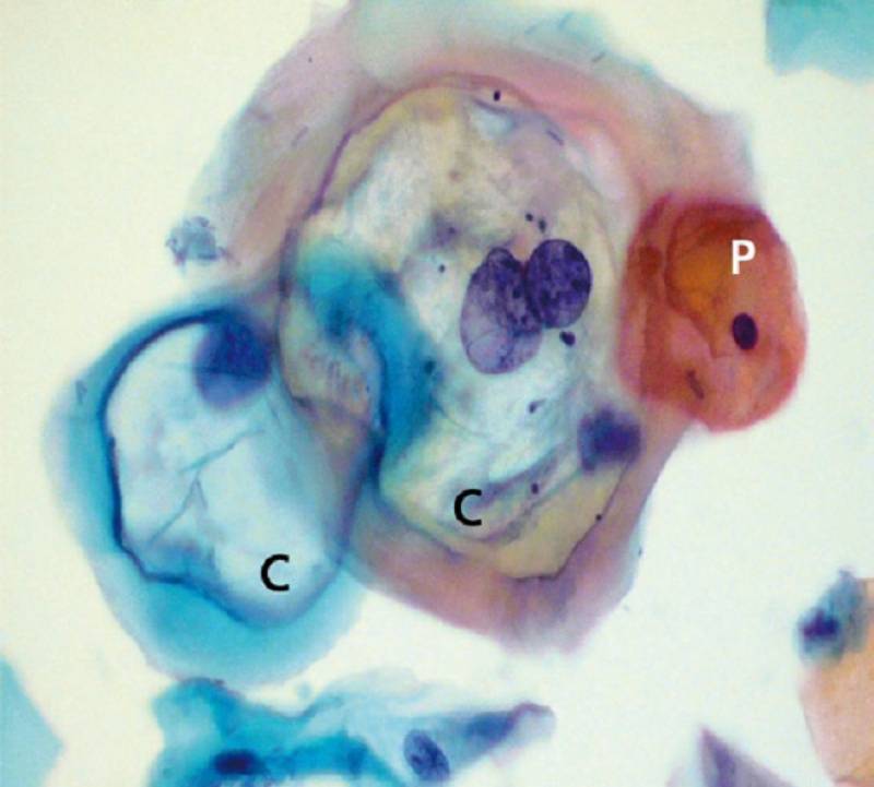 células uterinas