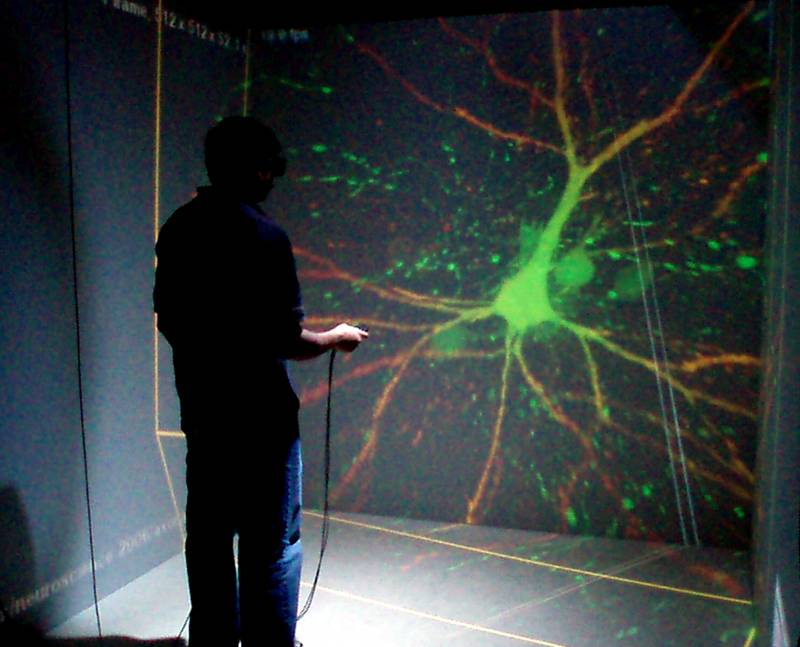 El interior del cerebro en 3D