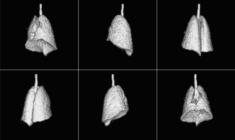 Toma de imágenes pulmonares