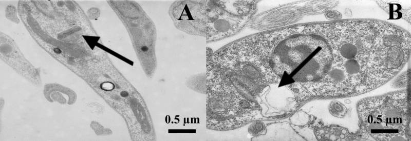 Imagen de microscopía electrónica