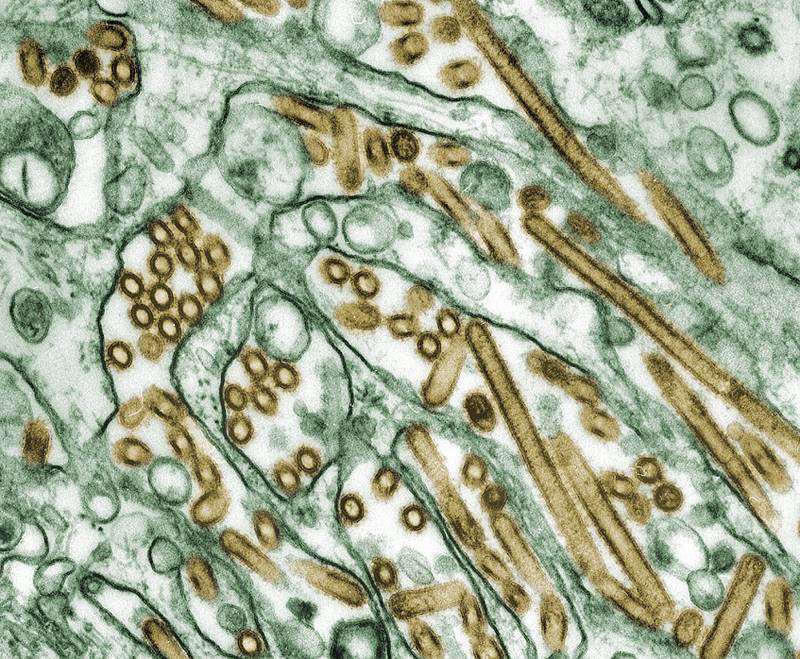 Cuestionan los datos de la OMS sobre prevalencia y mortalidad de la gripe aviar