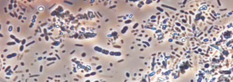 Muestra de microbiota de heces humanas. / CSIC