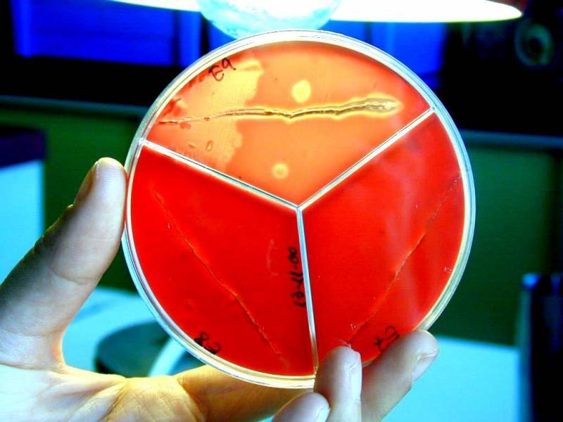 Manipulación de la bacteria 'brachyspira hyodysenteriae', causante de la disentería en cerdos. Imagen: Aquilón. 