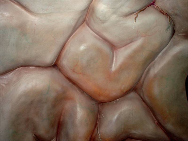 cerebro
