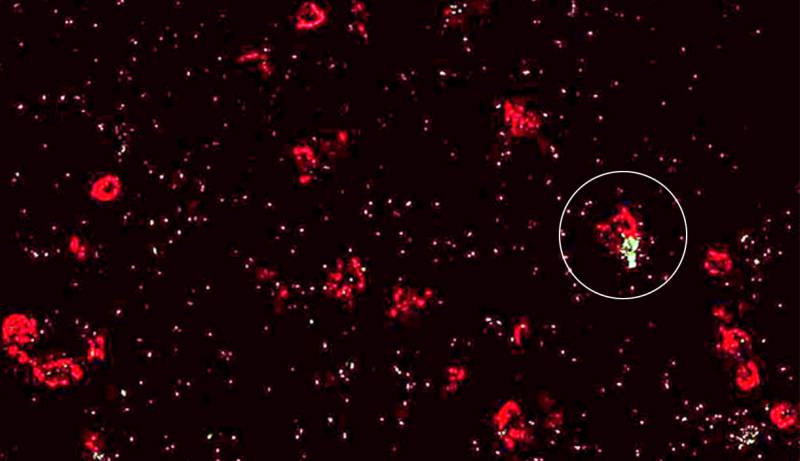 Desarrollan un mapa para vaticinar los resultados de las infecciones virales