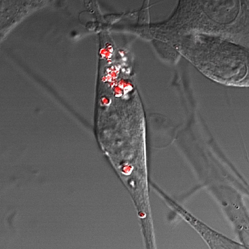 Aumentan la eficiencia de los fotocatalizadores en el tratamiento contra el cáncer