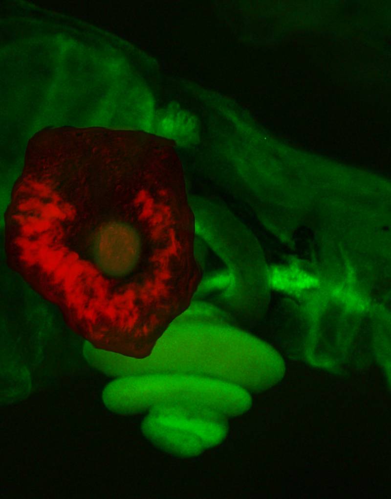  Identifican una causa molecular de la predisposición a sufrir cáncer de colon
