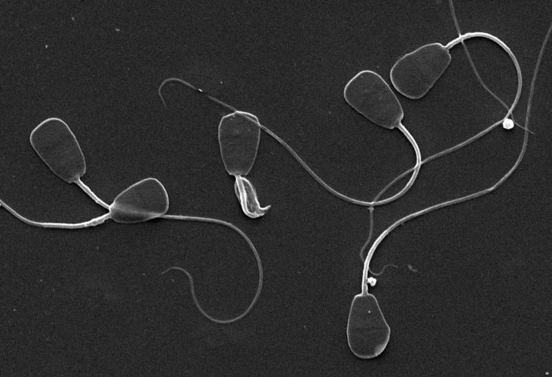 La consaguinidad aumenta el daño en el ADN de los espermatozoides