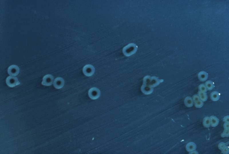 La infección de la bacteria causante de la salmonelosis depende del nivel del hierro de su entorno