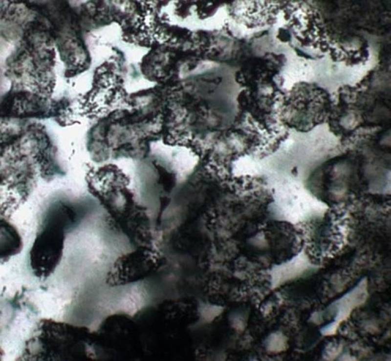 bacterias