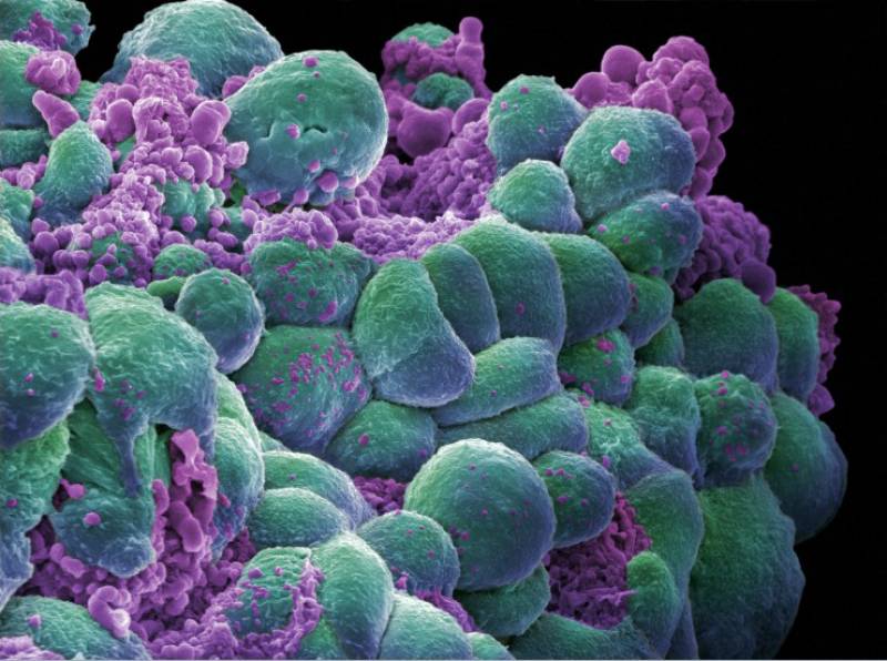 Células de cáncer de mama. Imagen: Wellcome Images  