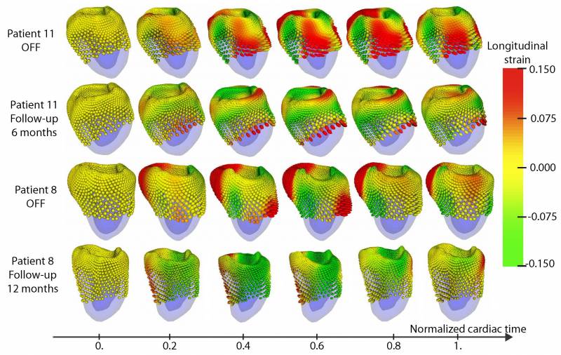 Visualización del tensor de deformación