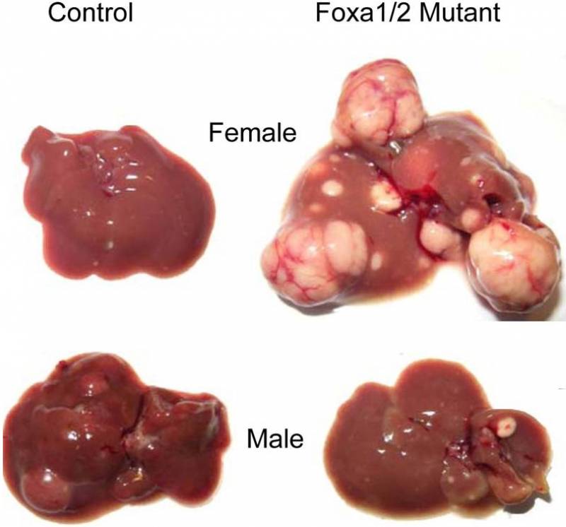 En las hembras, el receptor de estrógenos protege contra el cáncer de hígado