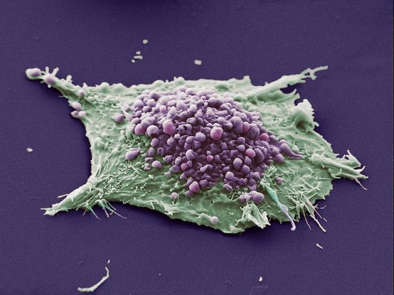 Entre los diferentes procesos que causan la muerte celular, en el caso de la 4-HPR destaca la apoptosis.