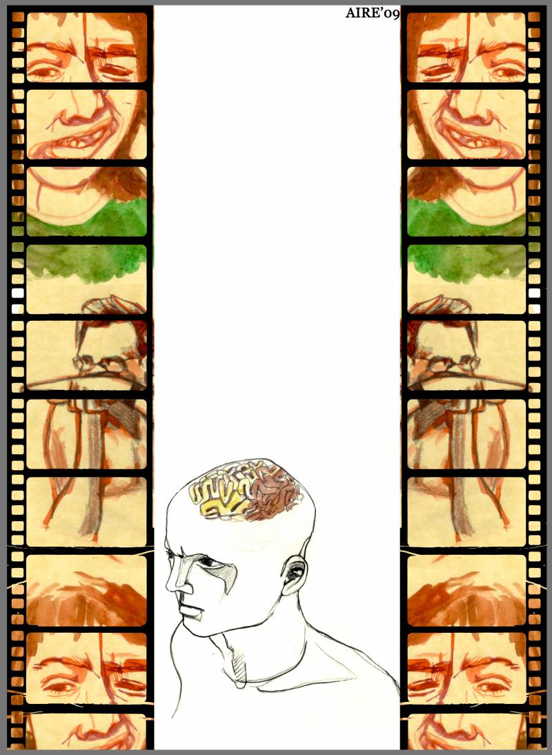 La estimulación cerebral profunda puede ser eficaz para tratar el síndrome de Tourette