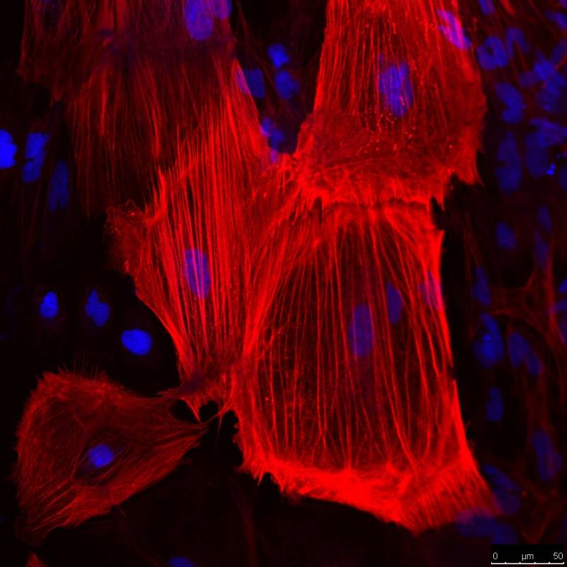 Consiguen reprogramar células del cordón umbilical para generar células madre pluripotentes