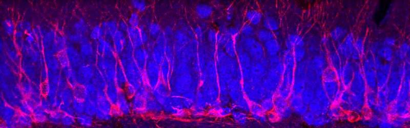 Psicodelia neuronal