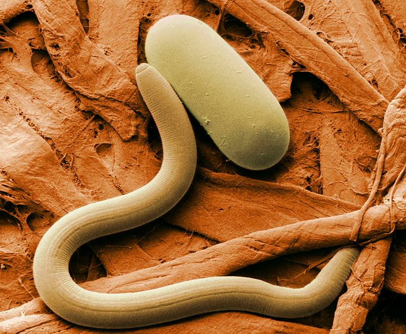 Microfotografía coloreada de un nematodo. 