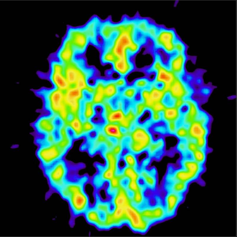 Desarrollan un circuito evolutivo como el del cerebro