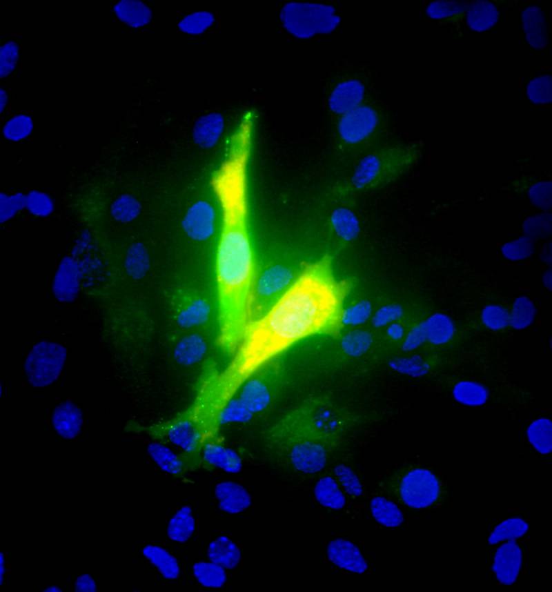 Descubren el mecanismo por el que las células madre rescatan neuronas 