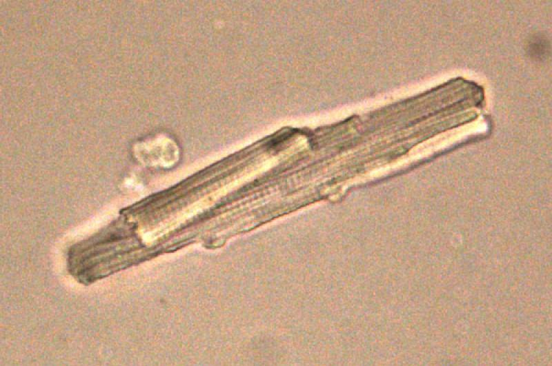 Célular auricular humana