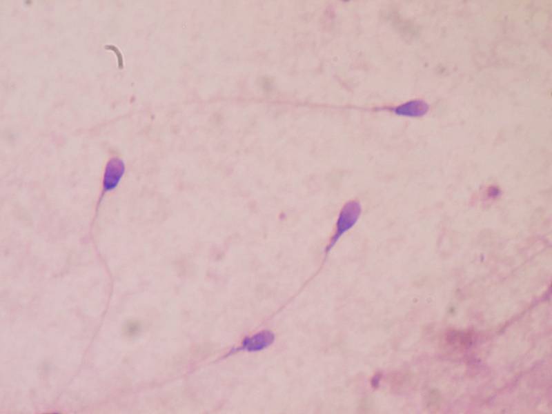 La calidad del semen depende de los antioxidantes