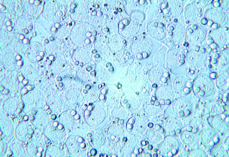 Revisan los estudios de mixosporidios que alteran la reproducción de peces y anfibios