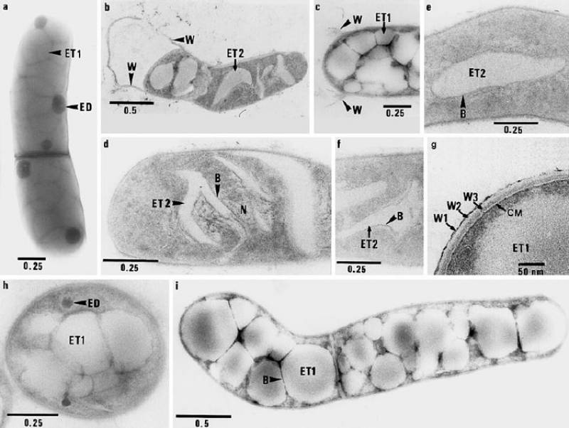 Imagen de bacterias con capacidad para almacenar aceites