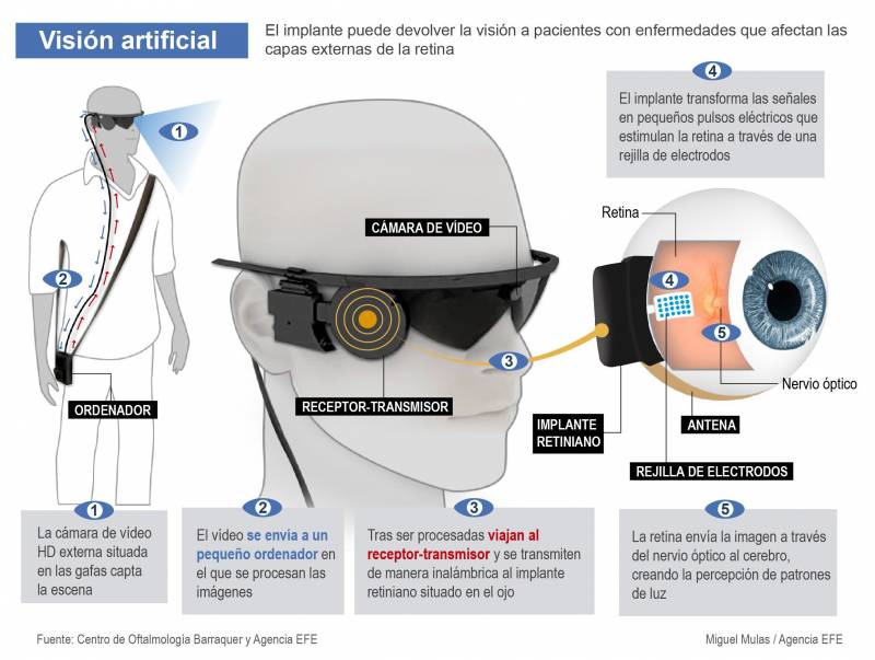 En esta infografía se explica qué y cómo funciona un ojo biónico./ Efe