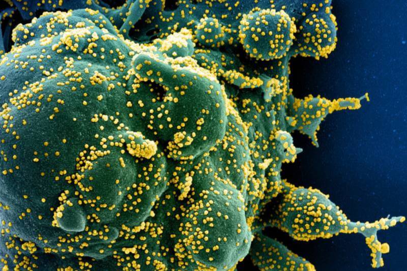 Imagen de microscopio electrónico de transmisión que muestra el SARS-CoV-2, el virus que causa la covid-19, en amarillo. / NIAID