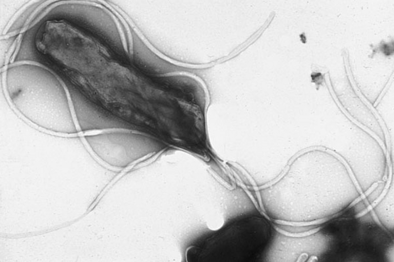 Helicobacter pylori visto al microscopio electrónico