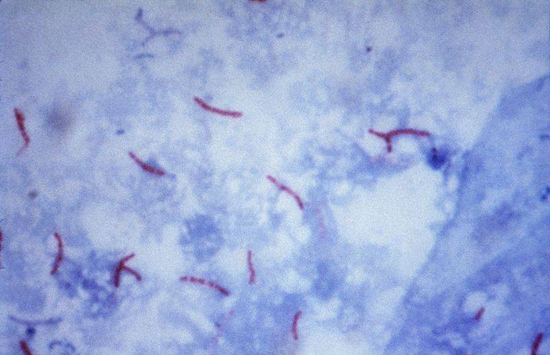 Mycobacterium tuberculosis 