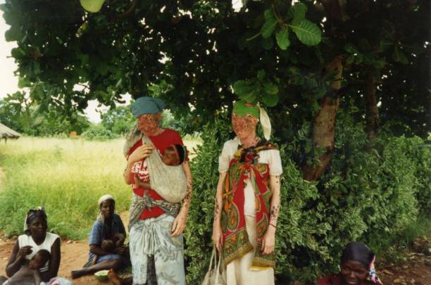 Gemelos mozambiqueños con albinismo oculocutáneo / Giovanna Luccardi Sirugo