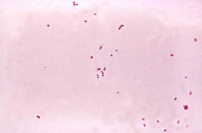 Neisseria meningitidis. Foto: Wikipedia.