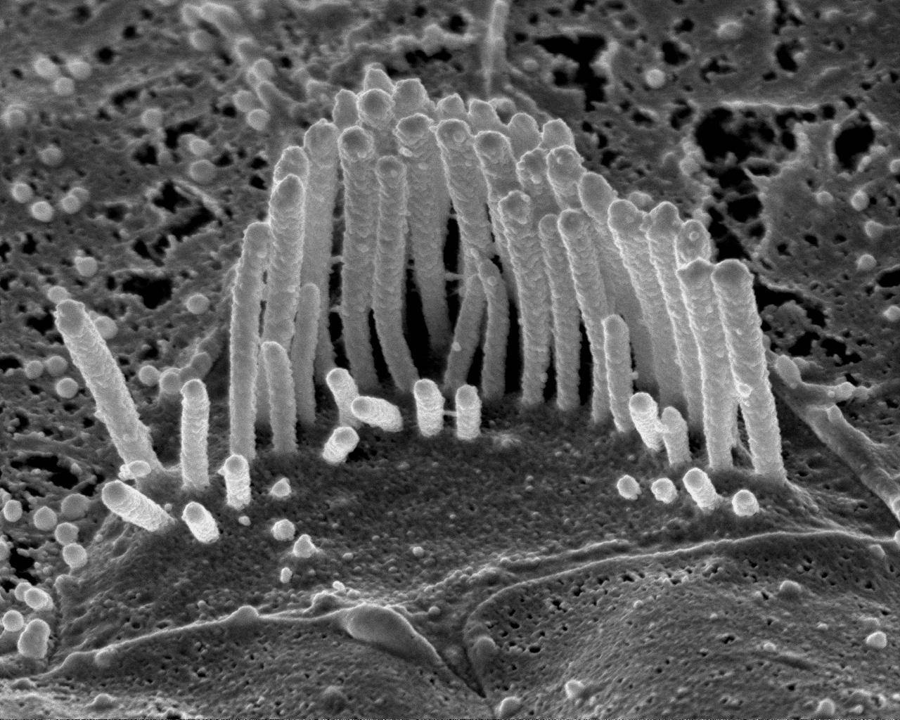 Una proteína llamada estereocilia intensifica las distorsiones en el oído interno