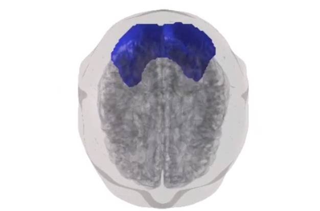 El cerebro se pone en guardia aumentando la actividad de algunas regiones cerebrales y suprimiendo otras