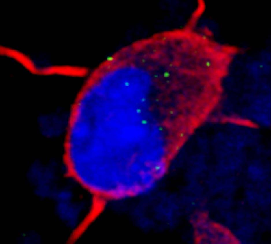 Células madre obtenidas de la piel combaten la destrucción neuronal 