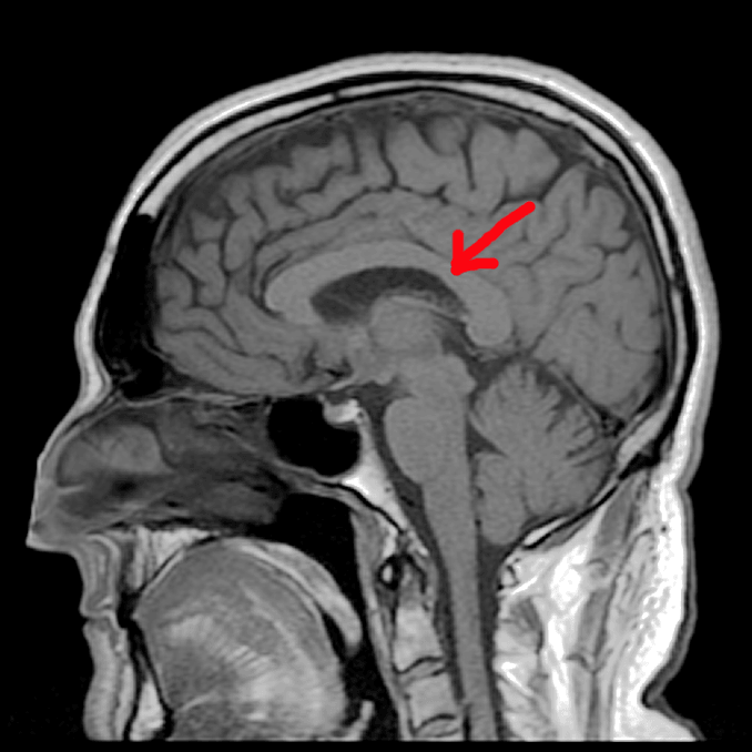 ¿Cómo sabe el cerebro que un perro es un perro?