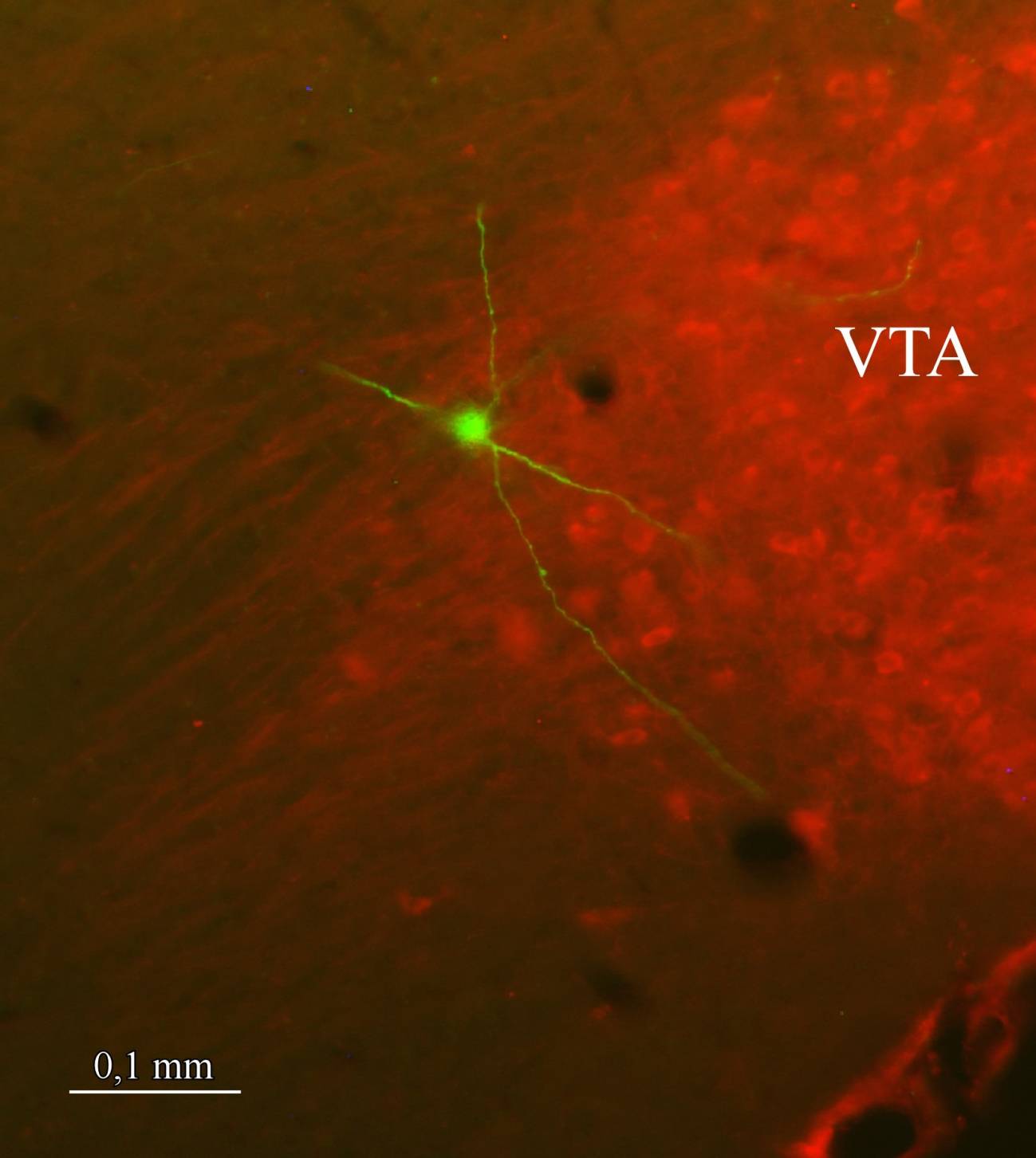 Descrito el circuito neuronal del placer