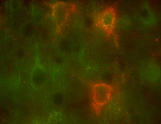 Descubren el posible mecanismo responsable de la toxicidad neuronal del litio
