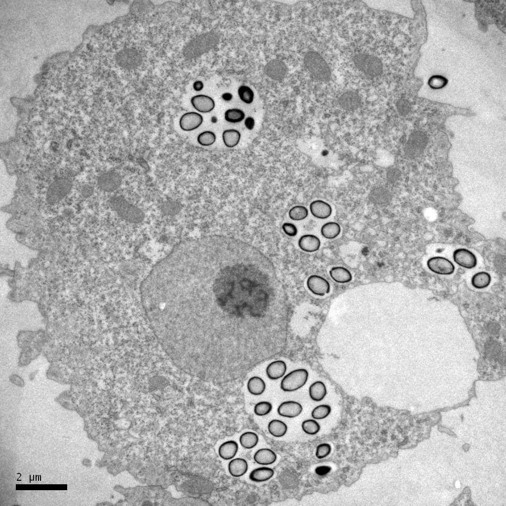 Descubren el virus más grande del mundo