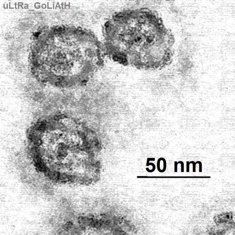 Descubren un nuevo tratamiento antiviral para la hepatitis C
