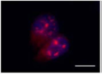 Descubren una nueva forma de control del material genético alterada en cáncer